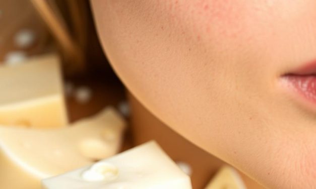 Nietolerancja laktozy a trądzik – jak dieta wpływa na skórę?